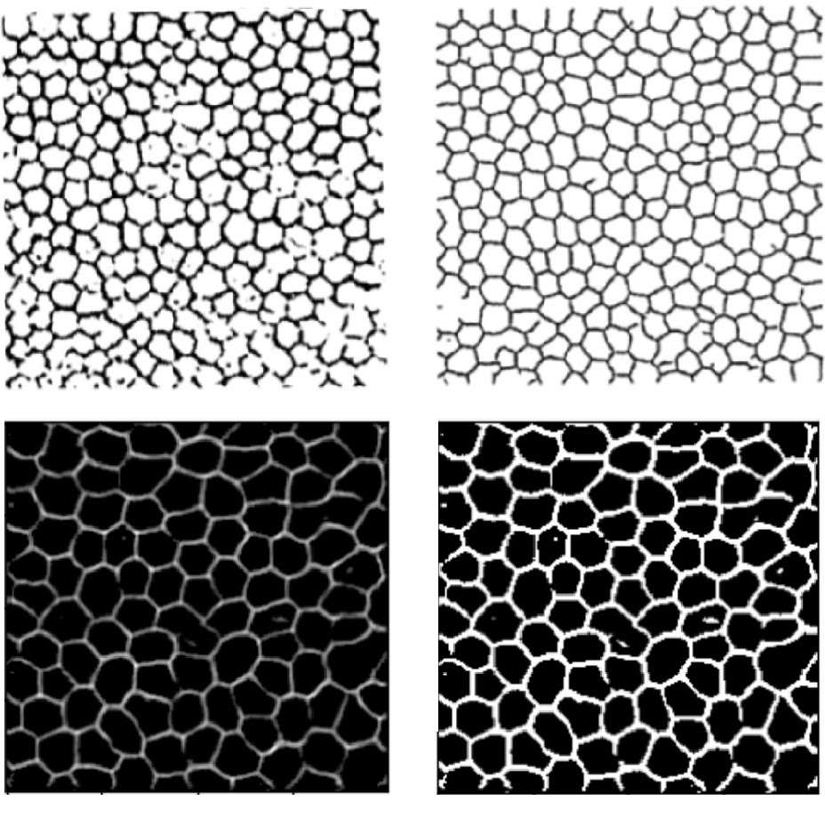 Corneal Endothelium